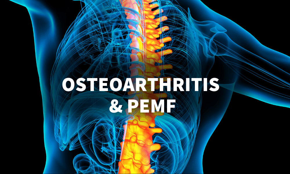 How Physical Therapists Can Treat Osteoarthritis Using PEMF